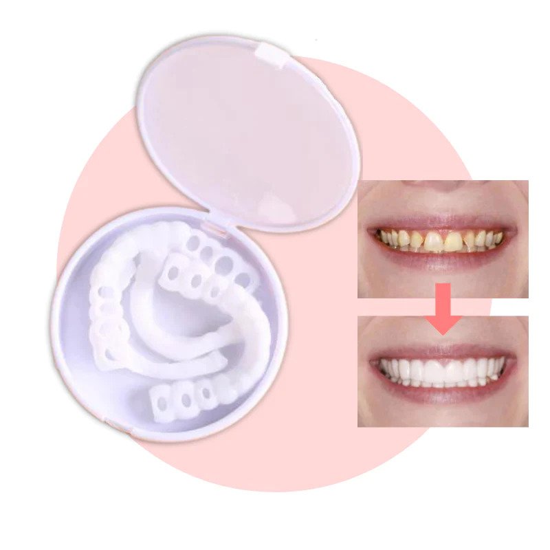 Veneers | Flexible Fit without Adhesive | Ideal for Eating, Drinking, and Daily Use